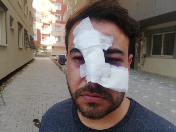 Hatay’da İstek Şarkıyı Bilmeyen Müzisyenin Yüzünde Şişe Kırdılar