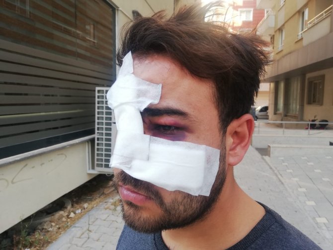 Hatay’da İstek Şarkıyı Bilmeyen Müzisyenin Yüzünde Şişe Kırdılar