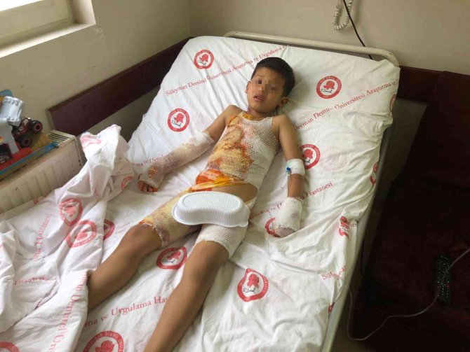 Anaokulunda Üzerine Sıcak Su Dökülen Çocuk Tedavi Altına Alındı