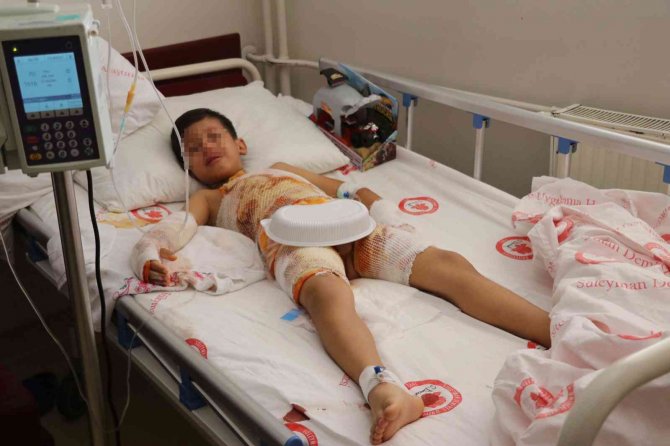 Anaokulunda Üzerine Sıcak Su Dökülen Çocuk Tedavi Altına Alındı
