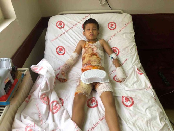 Anaokulunda Üzerine Sıcak Su Dökülen Çocuk Tedavi Altına Alındı