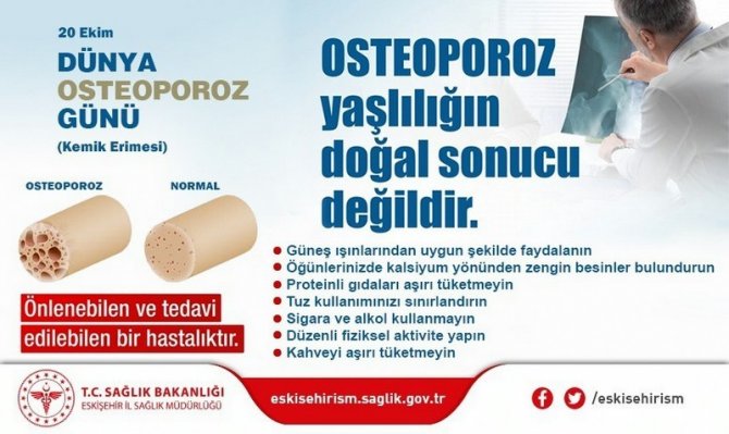 20 Ekim Dünya Osteoporoz Günü