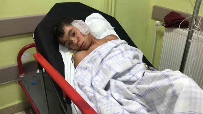 Sahipsiz Köpeklerin Dehşeti Yaşattığı Çocuğun Annesi: "Kanlar İçinde Yatıyordu"