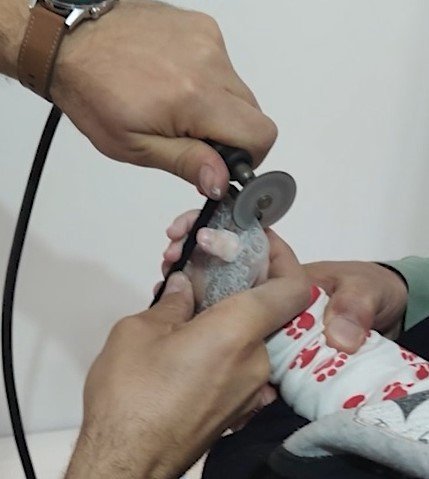 Minik Bebeğin Parmağı Öyle Bir Yere Sıkıştı Ki Gören Şaşkına Döndü