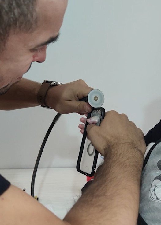 Minik Bebeğin Parmağı Öyle Bir Yere Sıkıştı Ki Gören Şaşkına Döndü