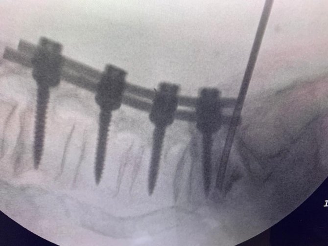 Türk Doktor, Bulduğu Yöntemle Literatüre Girdi