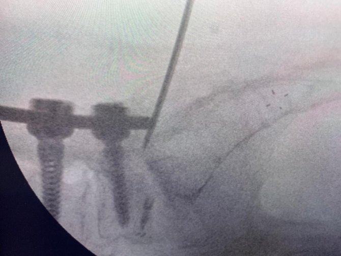 Türk Doktor, Bulduğu Yöntemle Literatüre Girdi