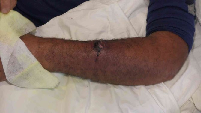 Aldığı Etten ’Şarbon’ Bulaştı, Kasap Dükkanı Mühürlendi