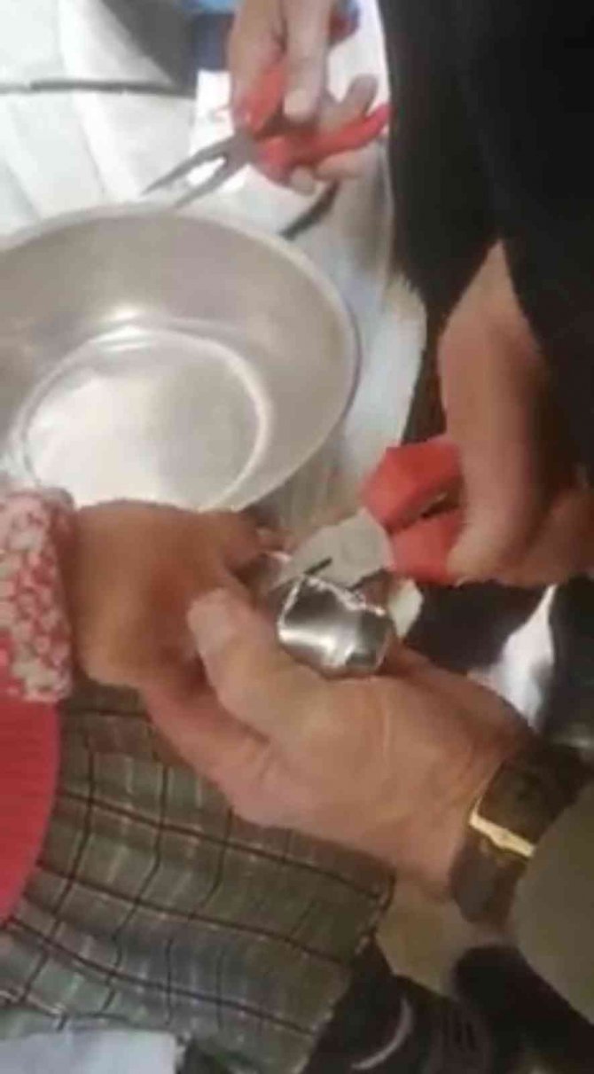 Parmağı Kapı Kolunun Demir Parçasına Sıkışan Minik Kızı İtfaiye Ekipleri Kurtardı