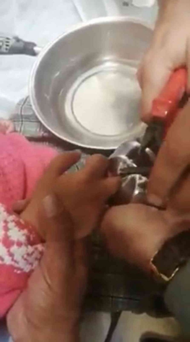Parmağı Kapı Kolunun Demir Parçasına Sıkışan Minik Kızı İtfaiye Ekipleri Kurtardı