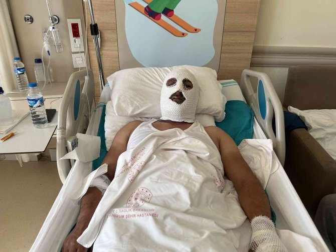 Doğal Gaz Borusunu Tamir Etmek İçin Gitti Felaketi Yaşadı