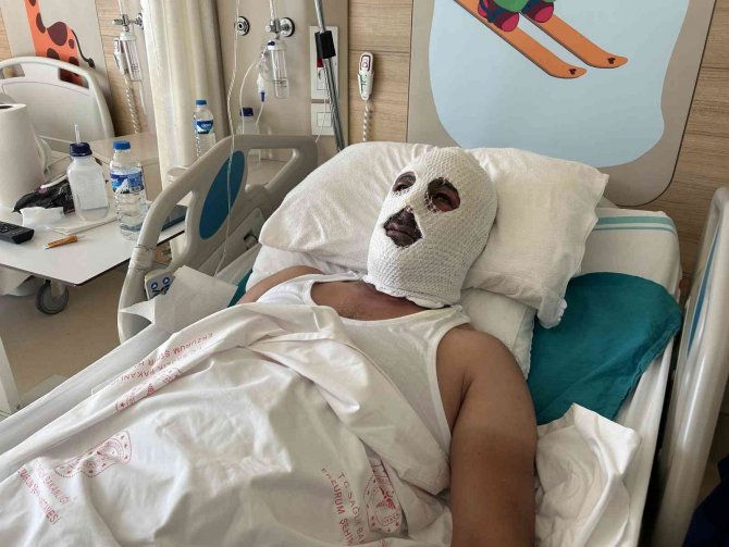 Doğal Gaz Borusunu Tamir Etmek İçin Gitti Felaketi Yaşadı
