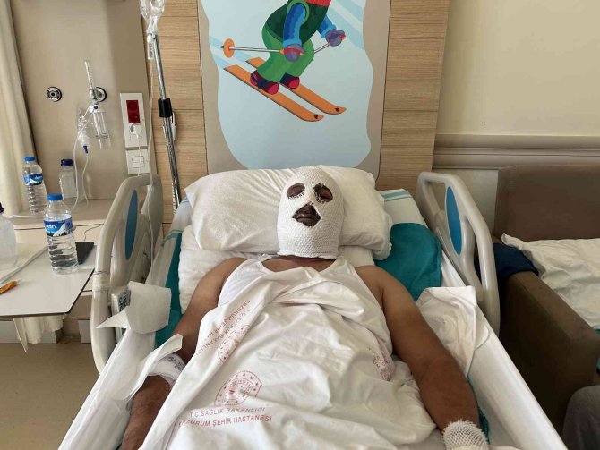 Doğal Gaz Borusunu Tamir Etmek İçin Gitti Felaketi Yaşadı
