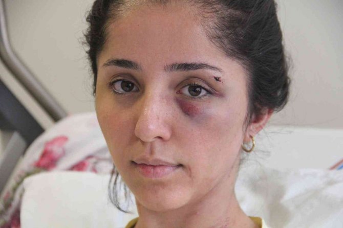 Sevgilisini 2 Saat Boyunca Darp Edip 5 Yerinden Bıçaklayan Doktorun 20 Yıla Kadar Hapsi İstendi
