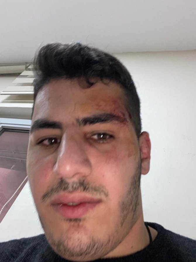 Küçükçekmece’de Kafeye Gelen Müşteri Çalışanı Darp Etti