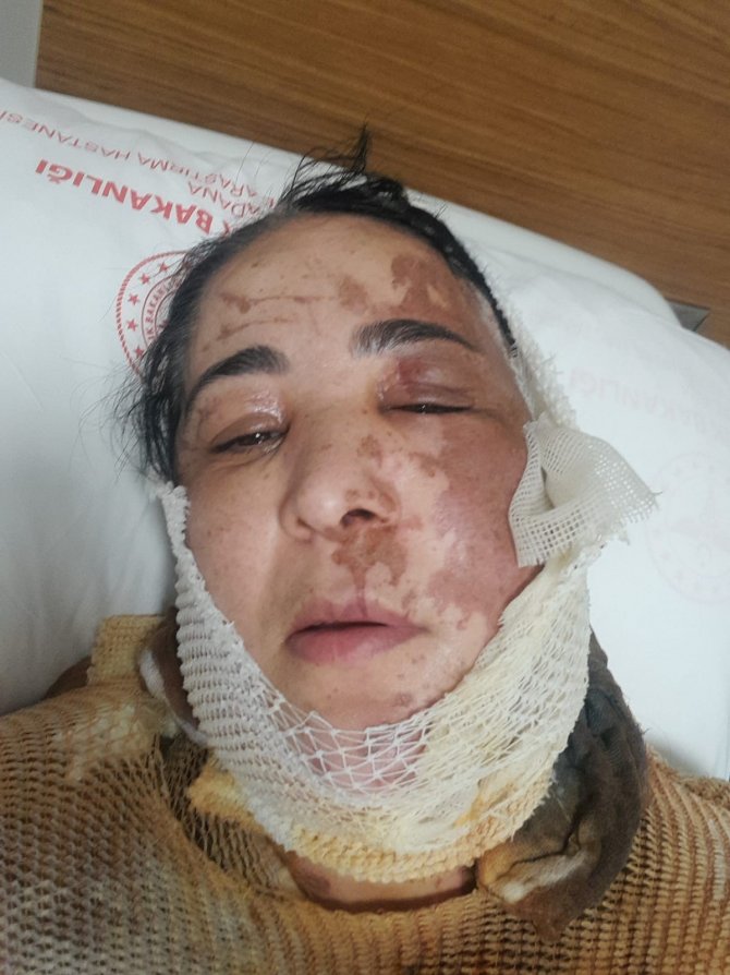 Adana’da Üvey Evlat Vahşeti