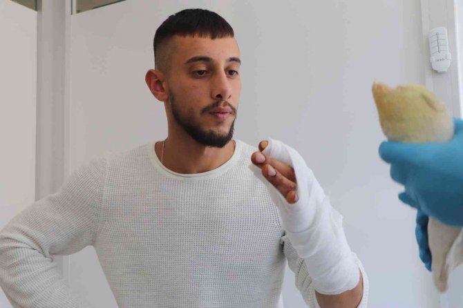 Kopan Başparmağı Yerine Dikildi