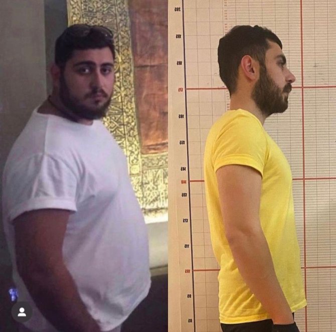 7 Ayda 50 Kilo Verdi, Son Halini Görenler Tanıyamadı