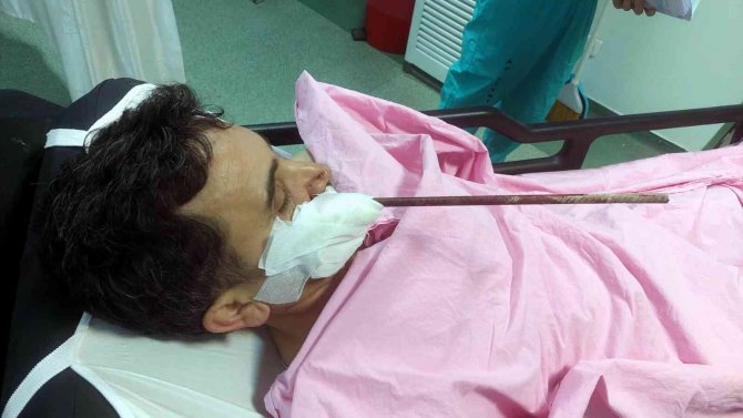 Yüzüne Saplanan Demirle Hastaneye Kaldırıldı