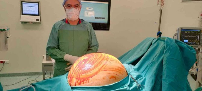 Karnından 35 Kilogramlık Kitle Çıktı