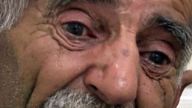 Bir Babanın En Zor Anı: “Bebeğimin Boğazına Kurşunlar Sıkarak Susturdular”