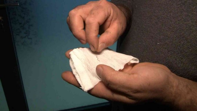 Arnavutköy’de Ekmek Yerken Ölümden Döndü