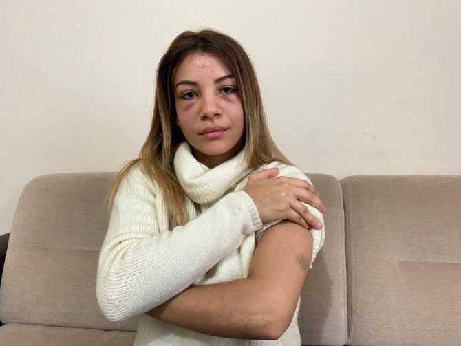Üsküdar’da Koca Dehşeti: 4 Aylık Hamile Karısını Çocuğunun Gözü Önünde Dövdü