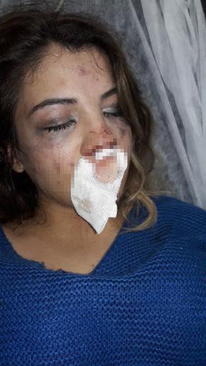 Üsküdar’da Koca Dehşeti: 4 Aylık Hamile Karısını Çocuğunun Gözü Önünde Dövdü