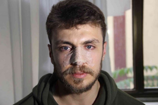 İ̇zmir’de Darp Edilen Asistan Doktorun Burnu Kırıldı