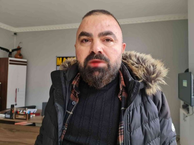 Chp’li Yöneticinin Yumrukladığı Gazeteci: “Suç Duyurusunda Bulunacağım, Türk Adaletine Güvenim Tam”