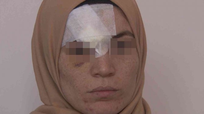 Kocası Darp Etti, 8 Dikiş Atıldı