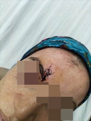 Kocası Darp Etti, 8 Dikiş Atıldı