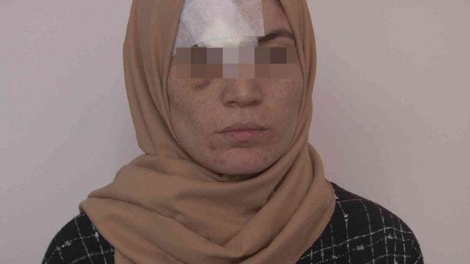 Kocası Darp Etti, 8 Dikiş Atıldı
