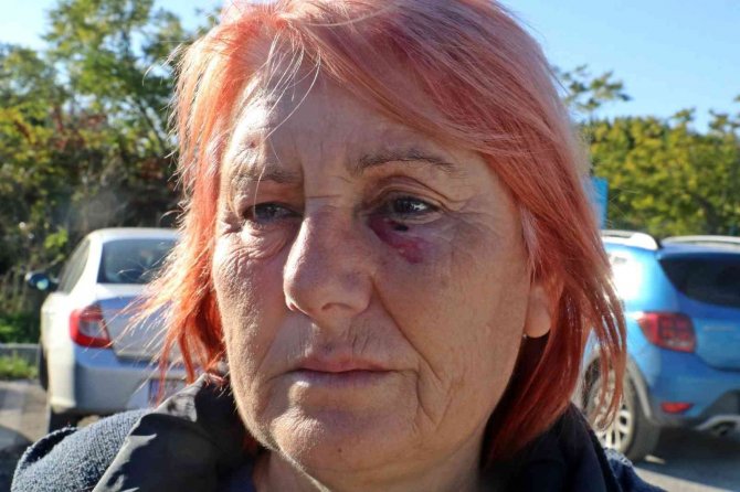 Antalya’da Ev Sahibi İle Kiracının Kavgası Güvenlik Kamerasına Yansıdı