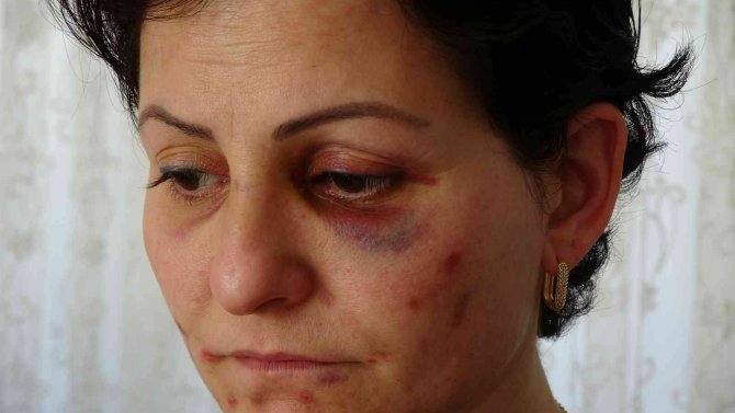 Arabayla Takip Ettikleri Anne Ve Kızı Döverek Hastanelik Ettiler