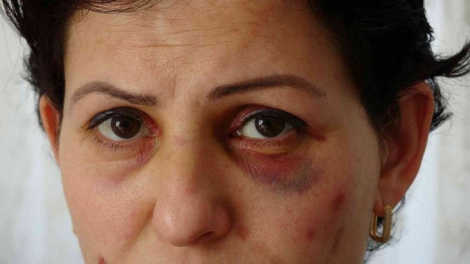 Arabayla Takip Ettikleri Anne Ve Kızı Döverek Hastanelik Ettiler