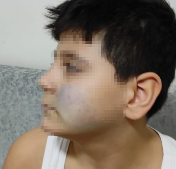 Başkent’te Akran Şiddeti İddiası