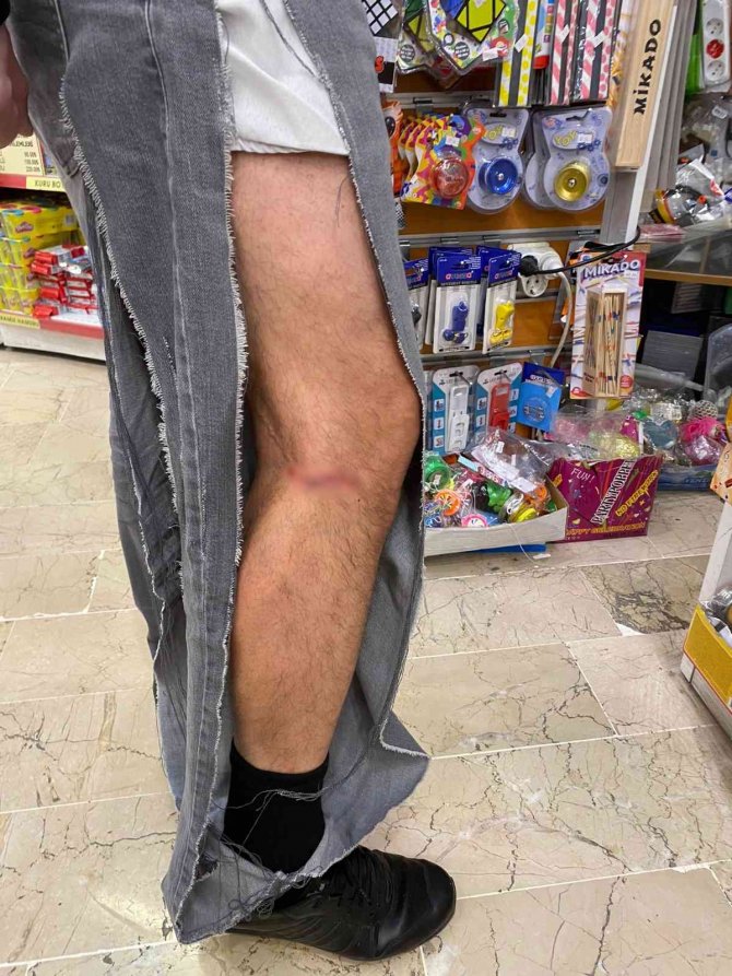 Çankaya’da Başıboş Köpekler Vatandaşın Kıyafetlerini Parçaladı
