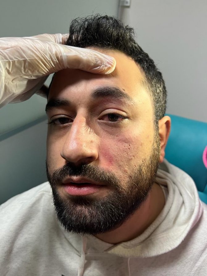 Elazığ’da Doktoru Darp Eden Şahıs Serbest Bırakıldı