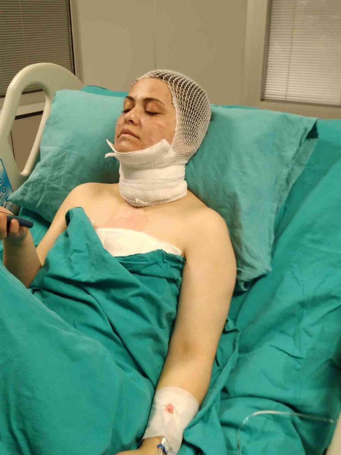 Bayrampaşa’da Dehşet Anları Kamerada: Eski Eşinin Yüzüne Kimyasal Madde Attı