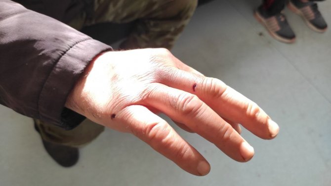 Boşanmakta Olan Eşinin Evini Tüfekle Bastı, Kayınpederi Ve Kayınvalidesini Yaraladı