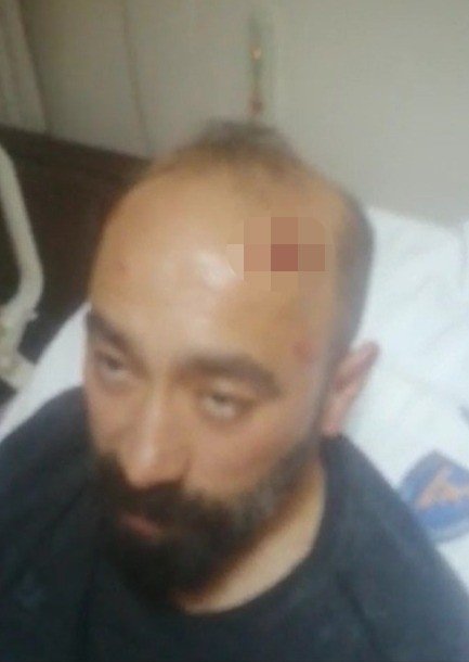 Müşteri Gibi Binen Saldırganın Hastanelik Ettiği Taksi Şoförü O Anları Anlattı