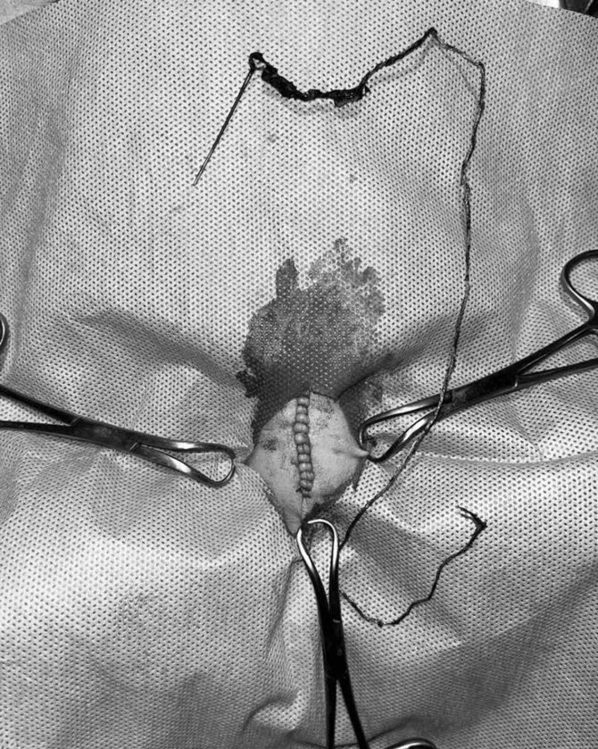 Kedinin Midesinden İğne Çıktı