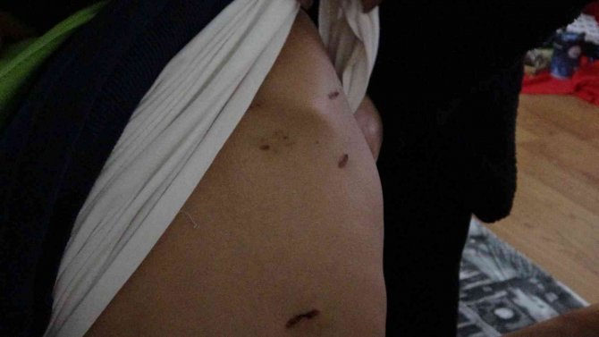 Pendik’te Okula Giden 10 Yaşındaki Çocuğu Sokak Köpekleri Saldırdı