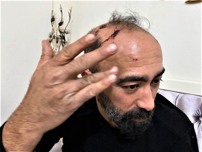 Taksi Sürücüsüne Kaldırım Taşıyla Dehşeti Yaşatan Zanlı Tutuklandı