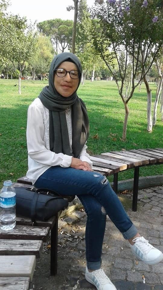 47 Kez Ameliyat Oldu, Yeni Yüzüne Kavuştu