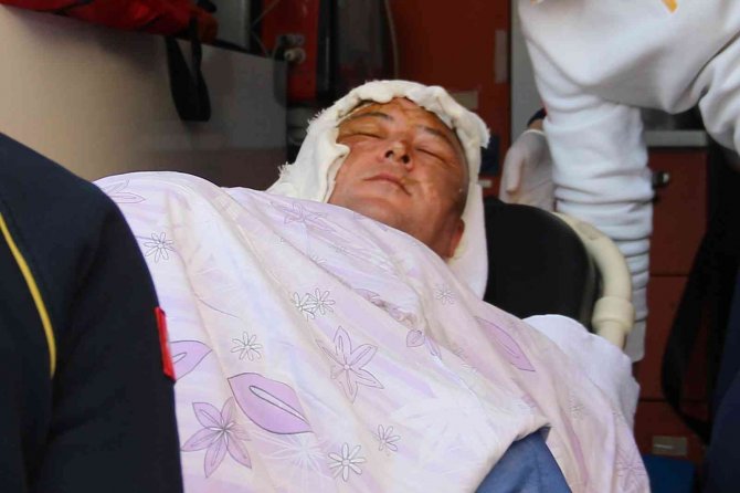 Tarım Kredi Süt Ürünleri Fabrikasındaki Kazada Ağır Yaralanan İşçi, İ̇zmir’de Tedavi Altında