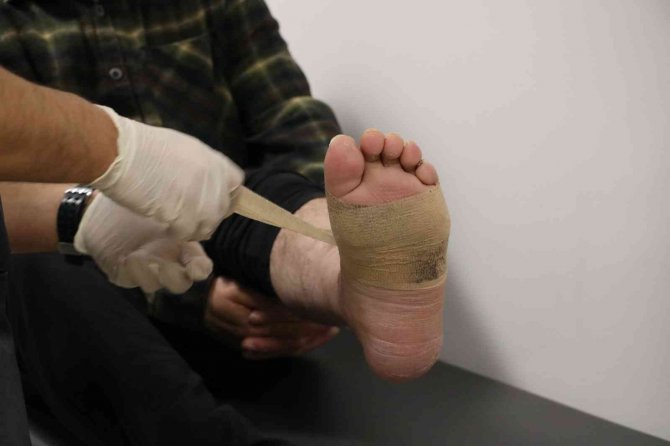 İ̇ş Kazasında Ayağı Koptu 7 Ay Sonra Yürümeye Başladı