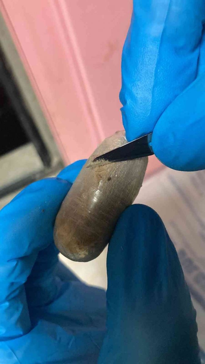 Batman’da Bir Kişinin Midesinden 714 Gram Eroin Ele Geçirildi