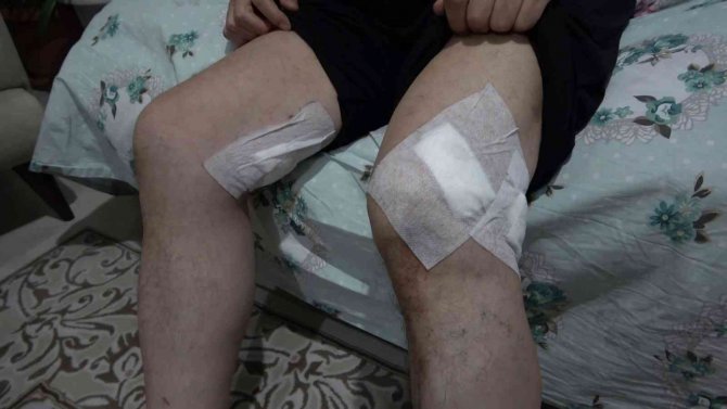 Pendik’te Aidat Tartışması Silahlı Kavgaya Dönüştü: 2 Yaralı